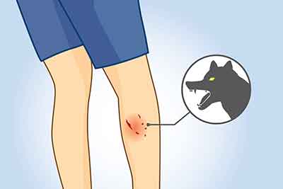 dog bite insurance 