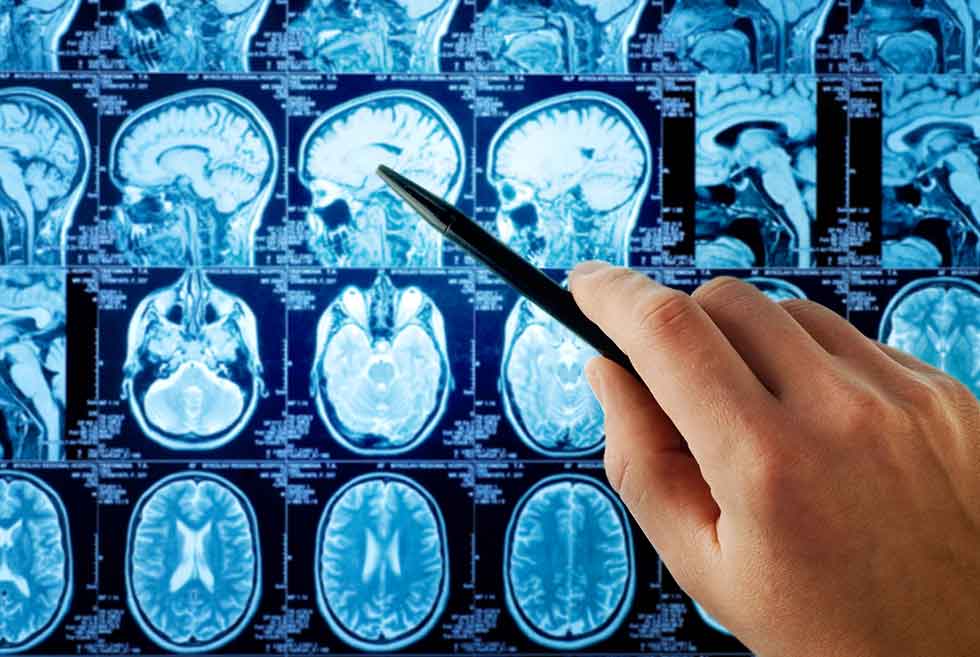 Treatment for a brain injury from a car accident 