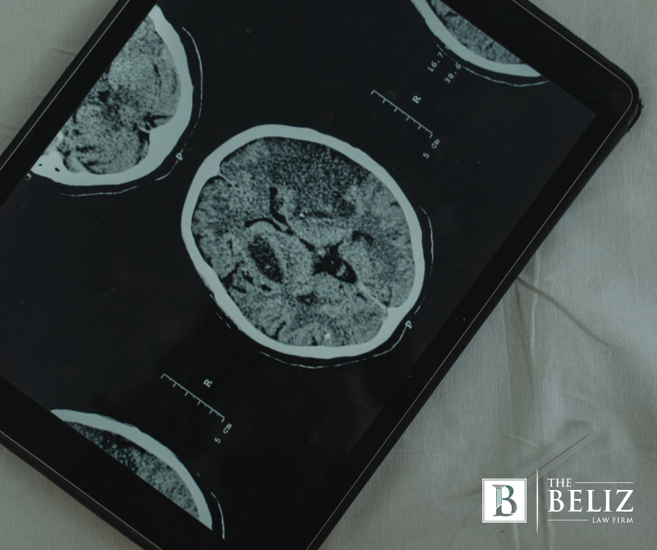Average Settlement for a Brain Injury in California