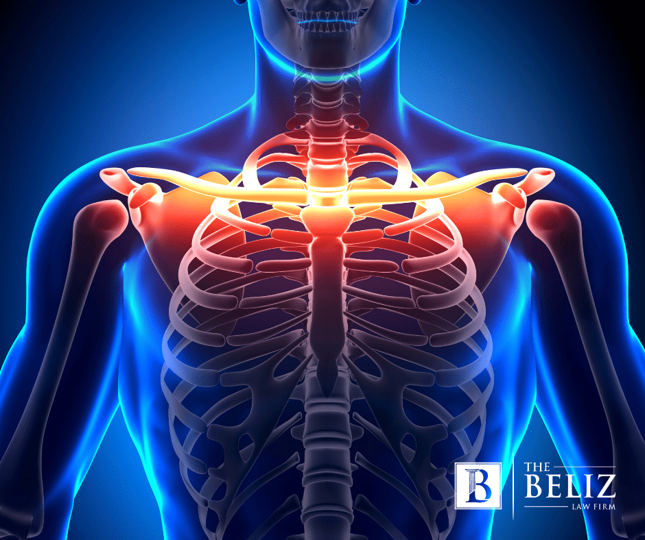 Average Settlement for a Broken Clavicle in California